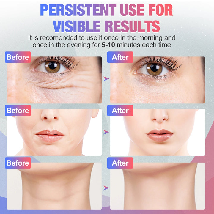 EMS Face & Neck Lift Massager - Rejuvenate, Tighten & Reduce Wrinkles