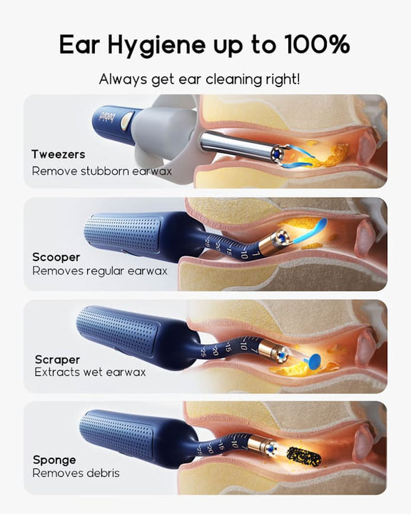 Bebird EarSight Plus I35R - Visual Ear Cleaner with HD Camera & Bendable Earpick