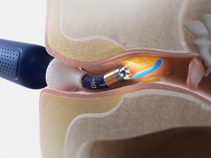 Bebird EarSight Plus I35R - Visual Ear Cleaner with HD Camera & Bendable Earpick