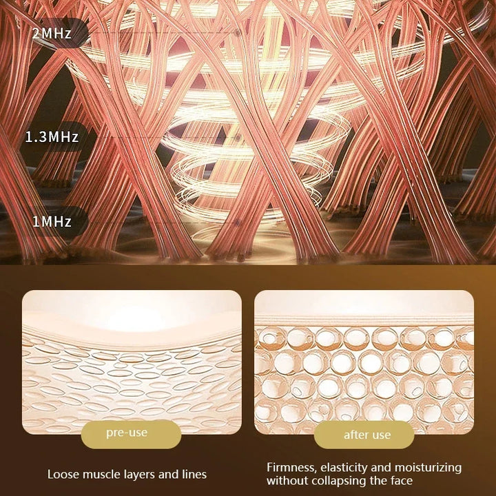 Neck & Facial Lifting Device - Anti-Aging, Wrinkle Reduction & Skin Tightening