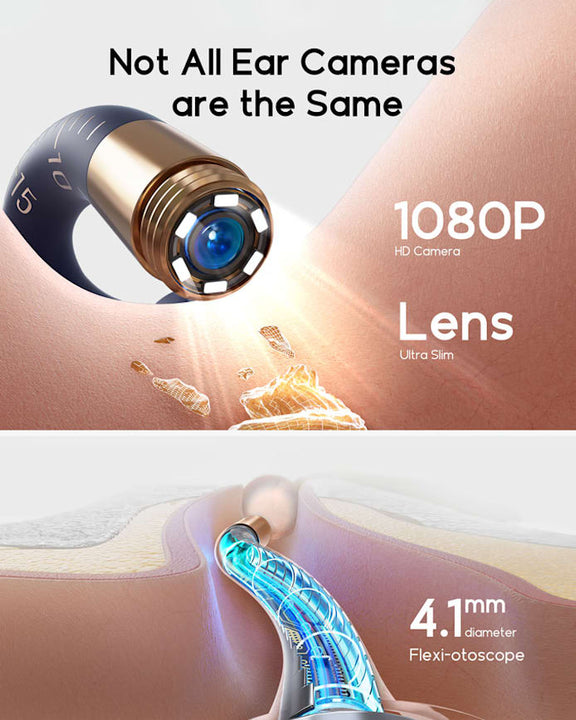 Bebird EarSight Plus I35R - Visual Ear Cleaner with HD Camera & Bendable Earpick