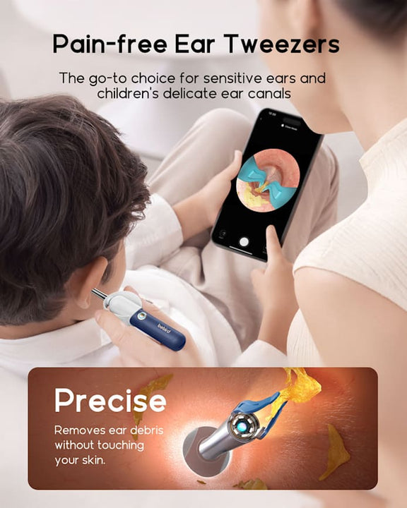 Bebird EarSight Plus I35R - Visual Ear Cleaner with HD Camera & Bendable Earpick